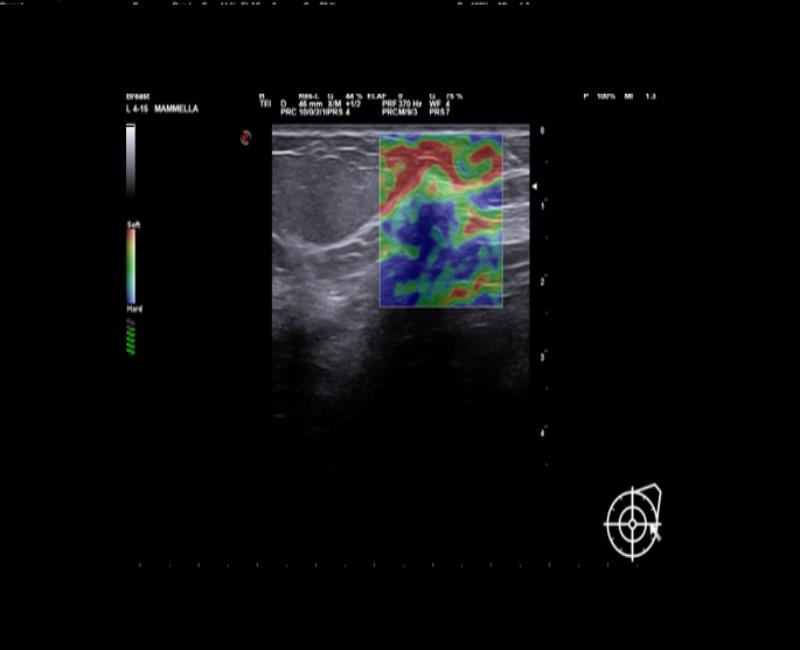 may sieu am mylab x6