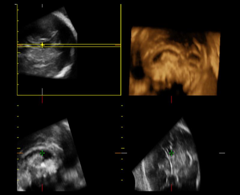 may sieu am mylab x6