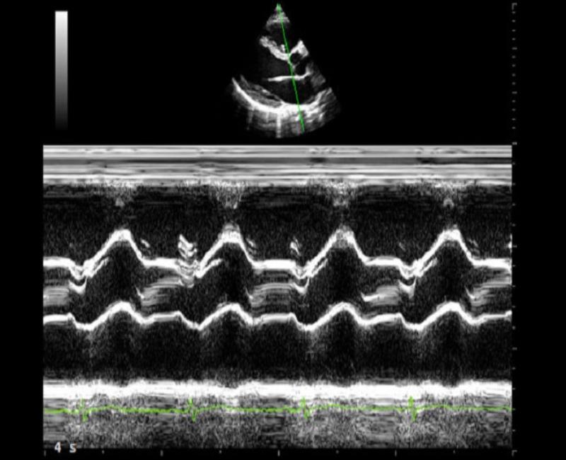 may sieu am mylab x6