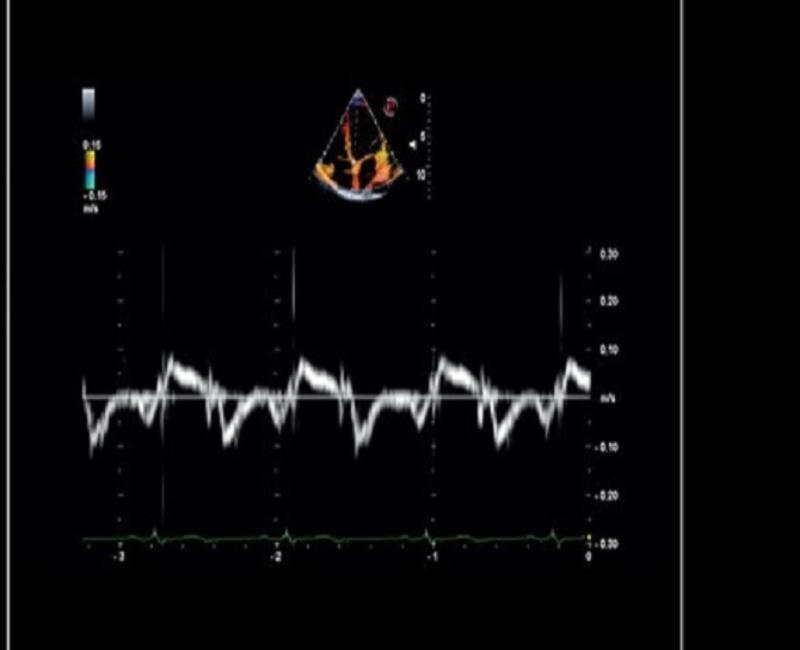 may sieu am mylab x6