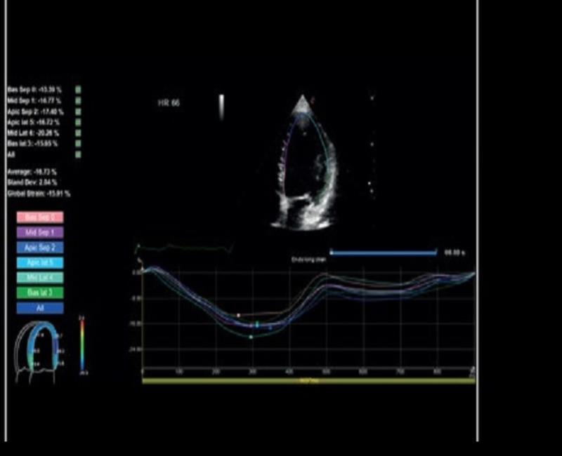 may sieu am mylab x6