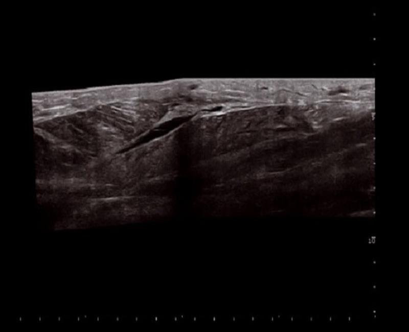 may sieu am mylab x6