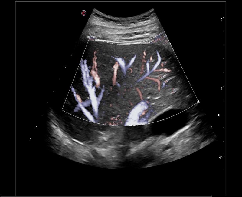 may sieu am mylab x6