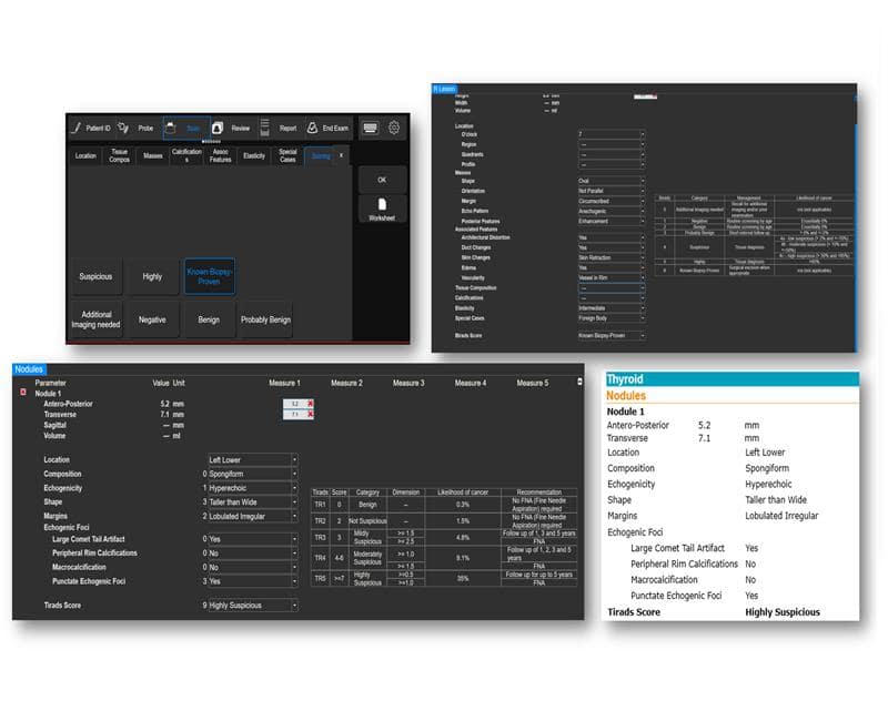 may sieu am mylab x6