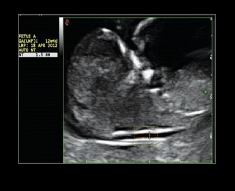 may sieu am mylab x6