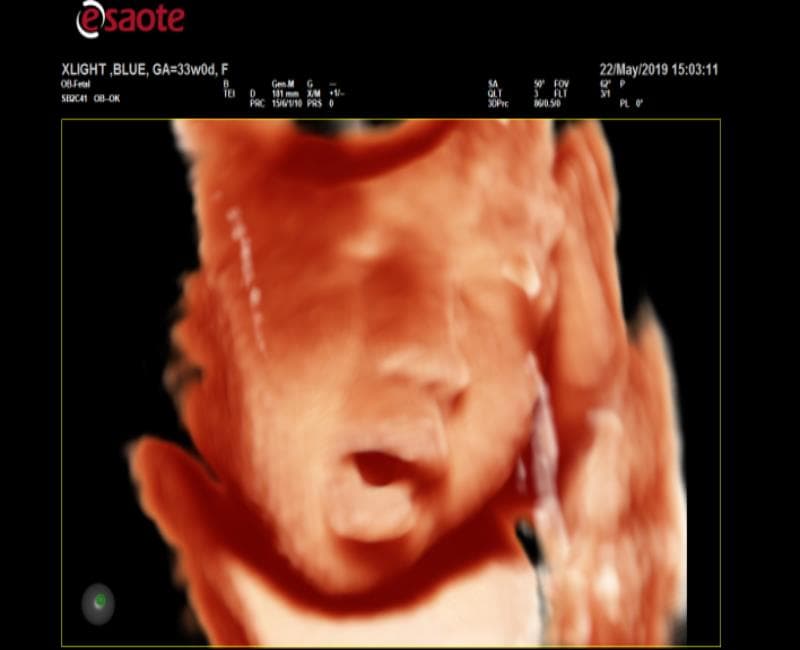 may sieu am mylab x6