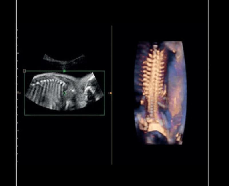 may sieu am mylab x6