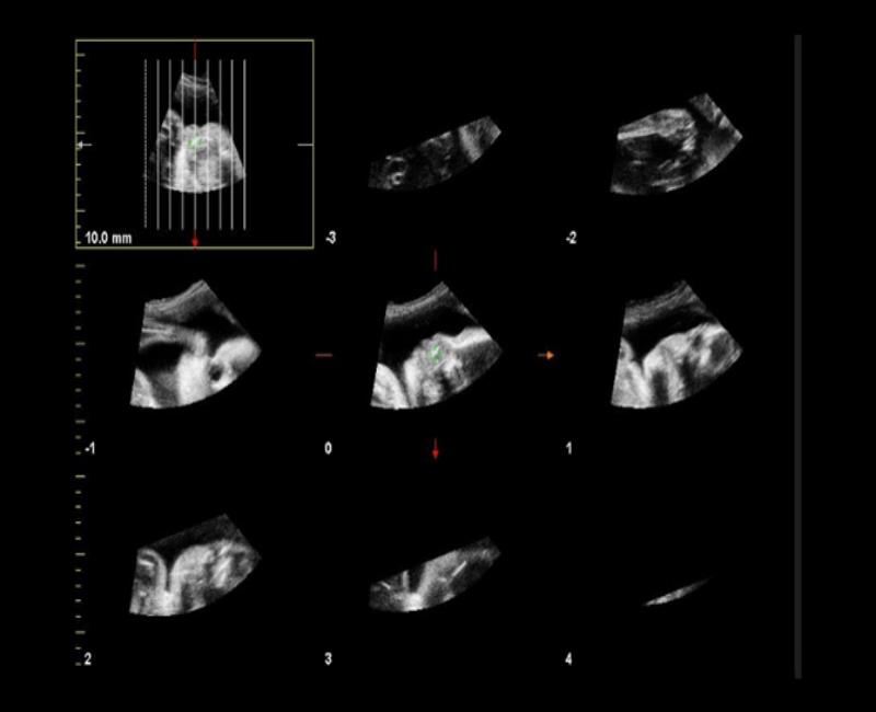 may sieu am mylab x6