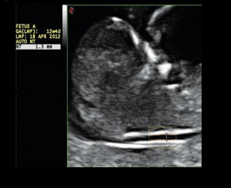 may sieu am mylab x7