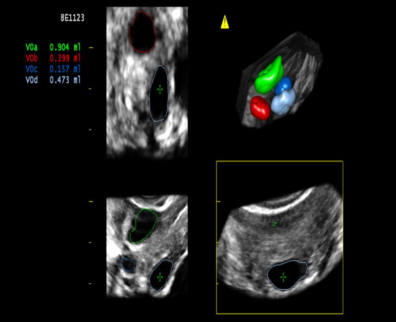 may sieu am mylab x7