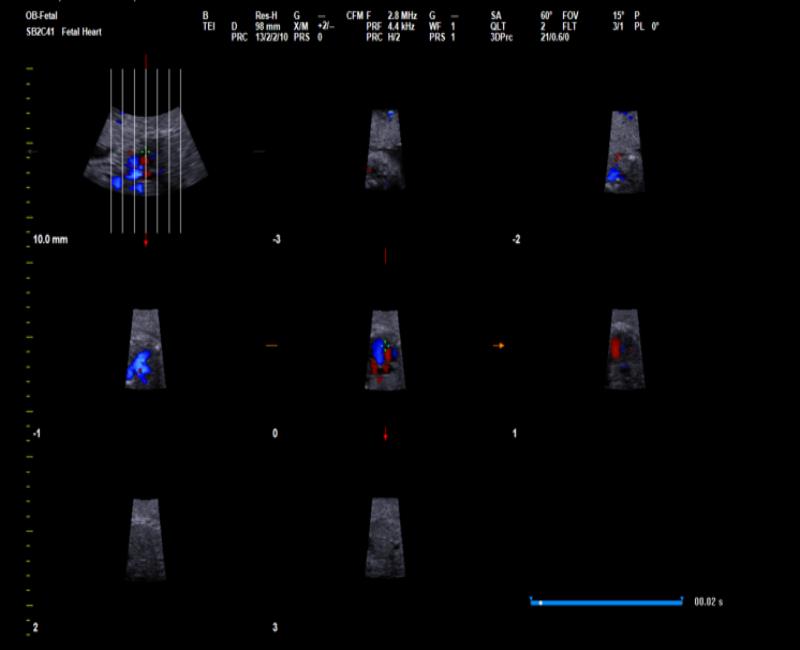 may sieu am mylab x7