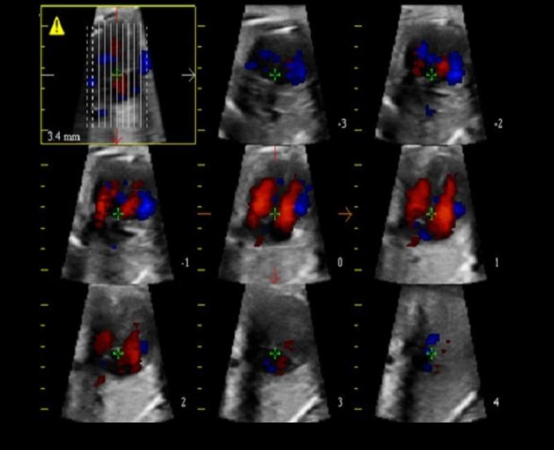 may sieu am mylab x7