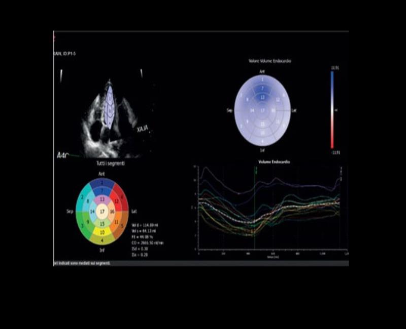 may sieu am mylab x7