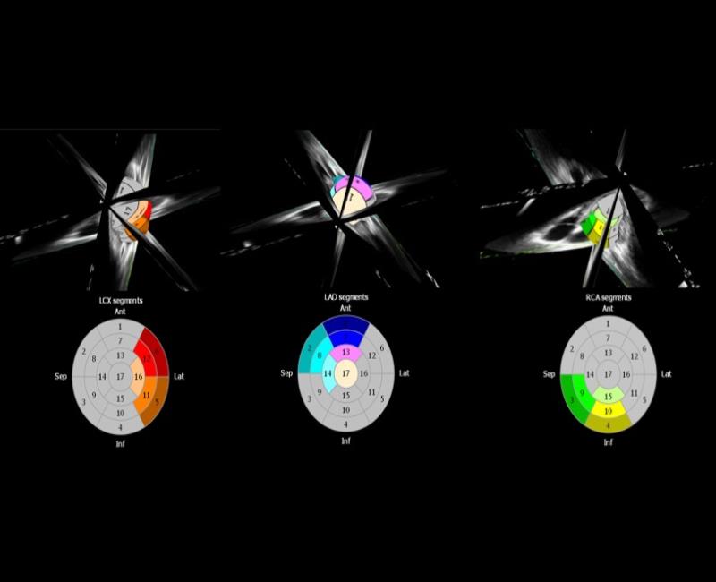 may sieu am mylab x7