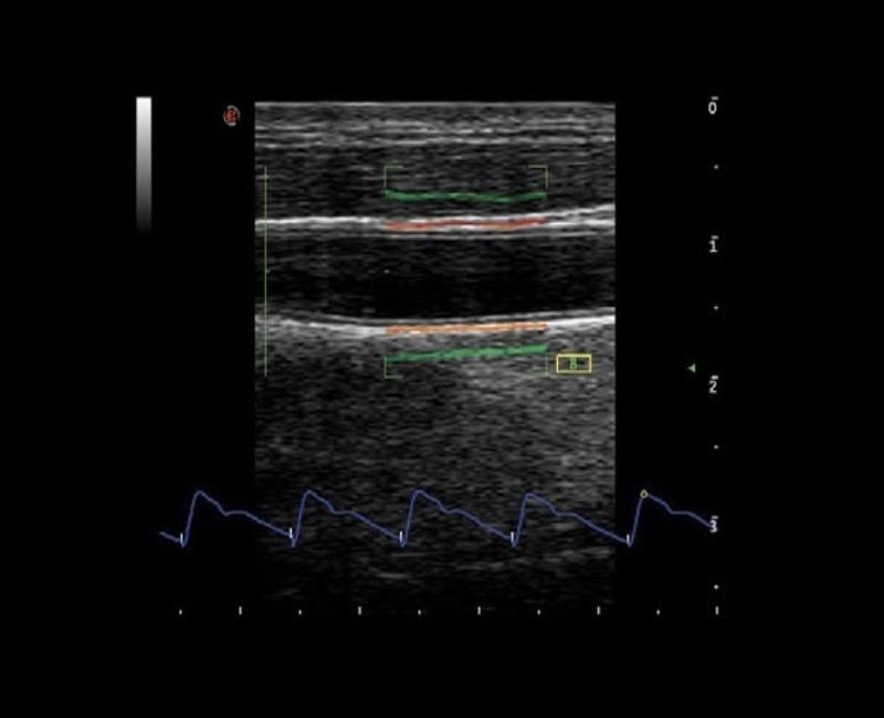 may sieu am mylab x7