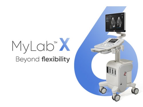 may sieu am mylab x6