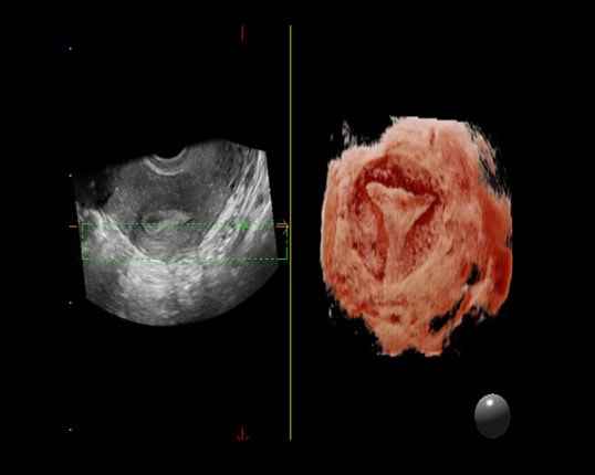 may sieu am mylab x7