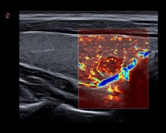 may sieu am mylab x7