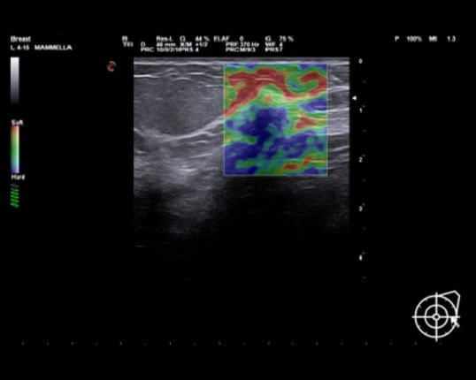 may sieu am mylab x7