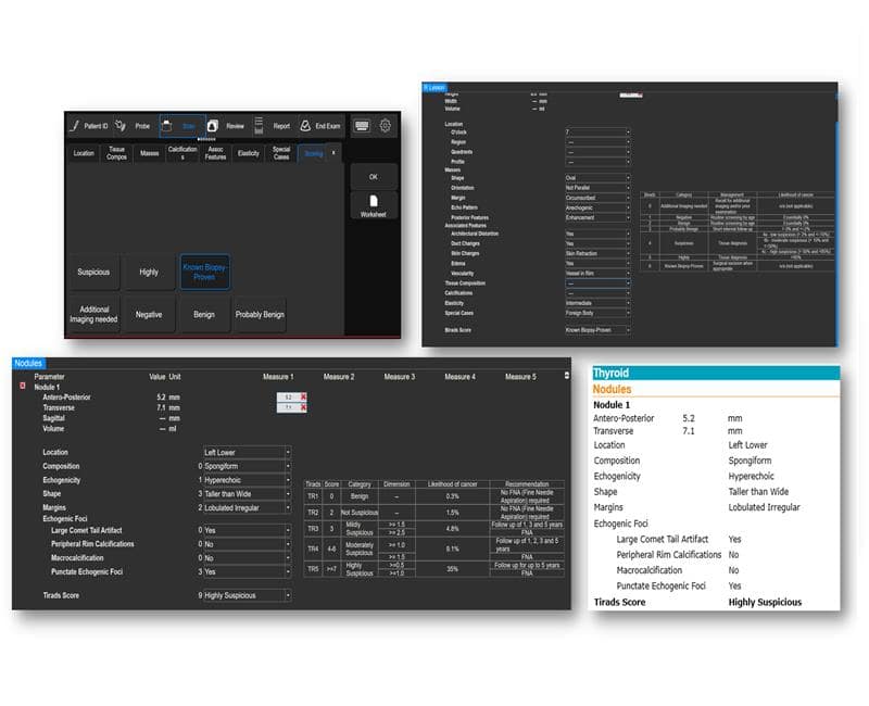 may sieu am mylab x7