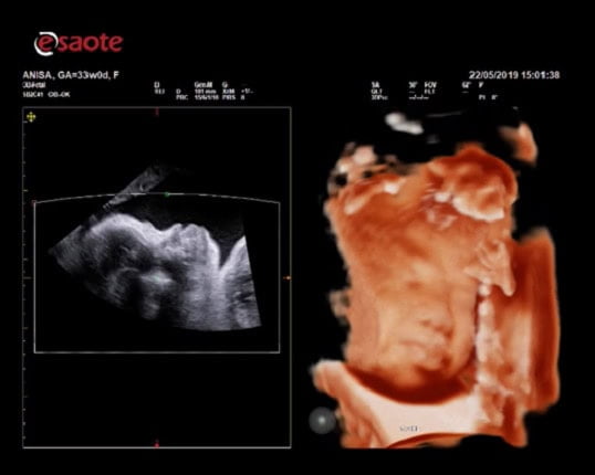 may sieu am mylab x7