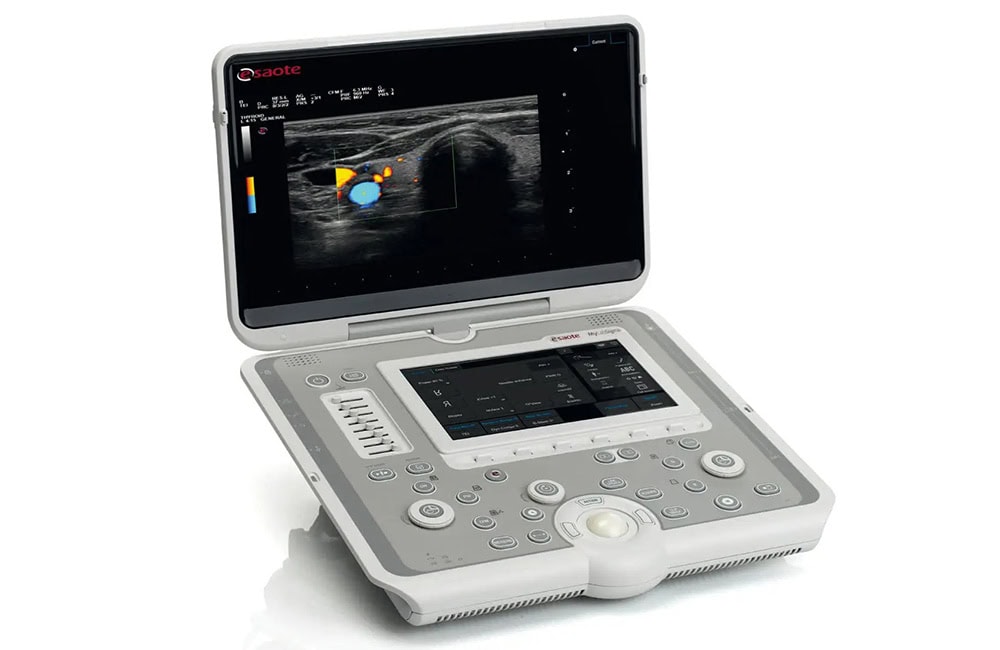 he thong sieu am mylab sigma