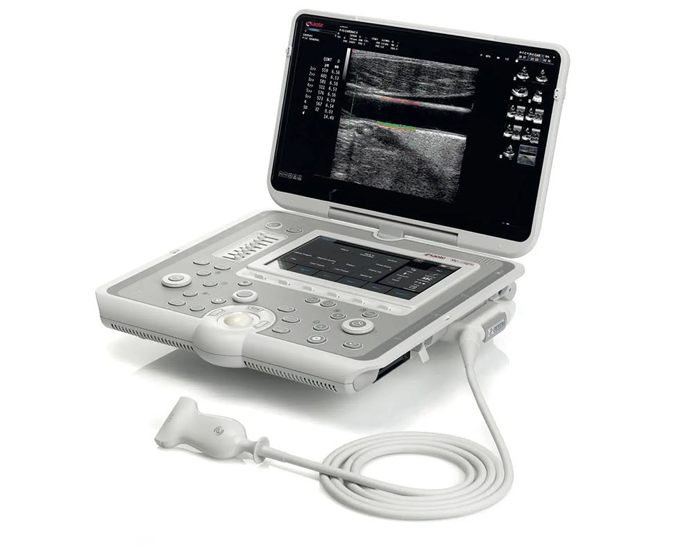 he thong sieu am mylab sigma