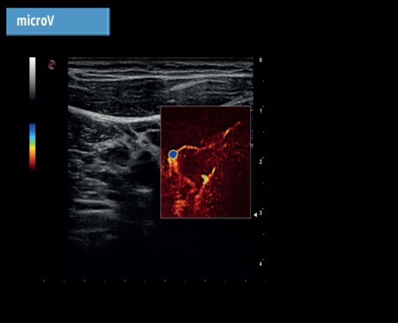 may sieu am mylab omega