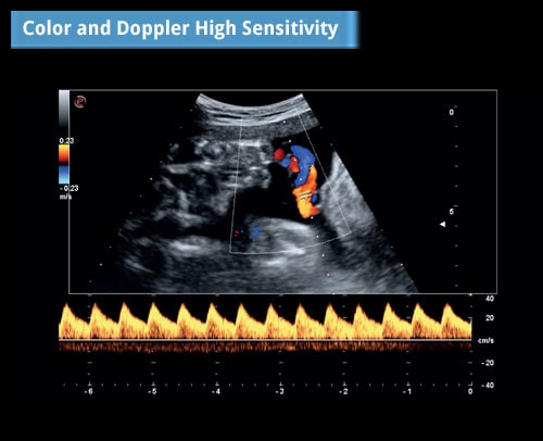 may sieu am mylab omega
