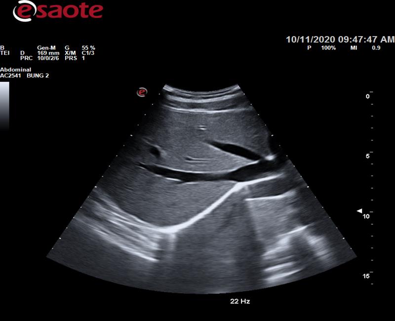 may sieu am mylab omega