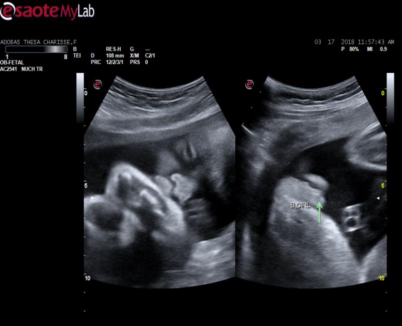 may sieu am mylab omega