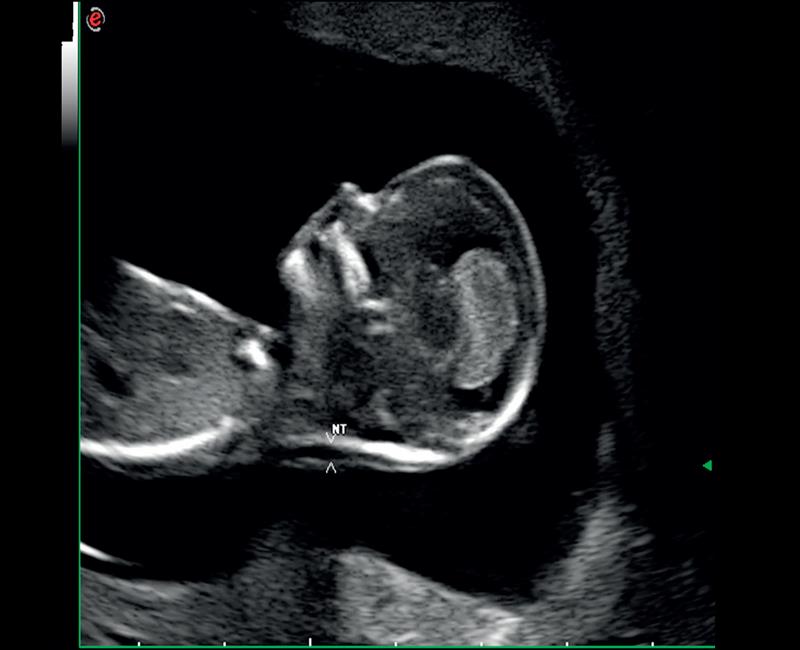 may sieu am mylab omega