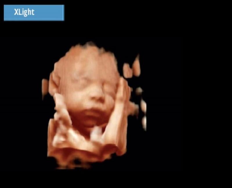 may sieu am mylab omega