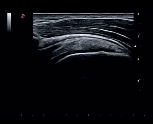 he thong sieu am mylab sigma