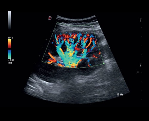 he thong sieu am mylab sigma