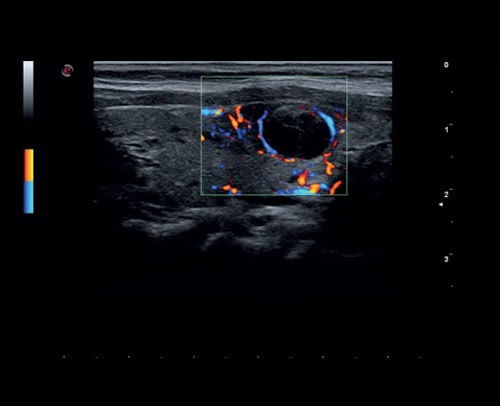 he thong sieu am mylab sigma