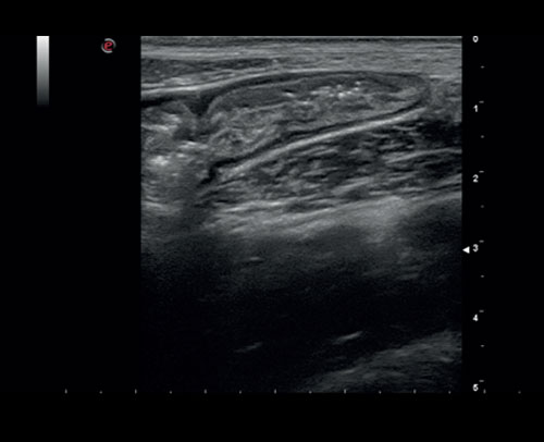 he thong sieu am mylab sigma