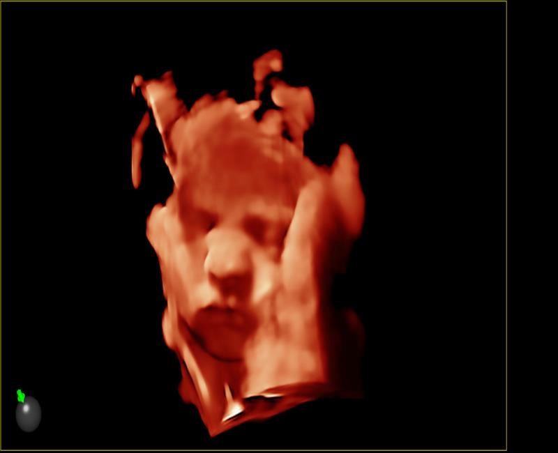 he thong sieu am mylab sigma