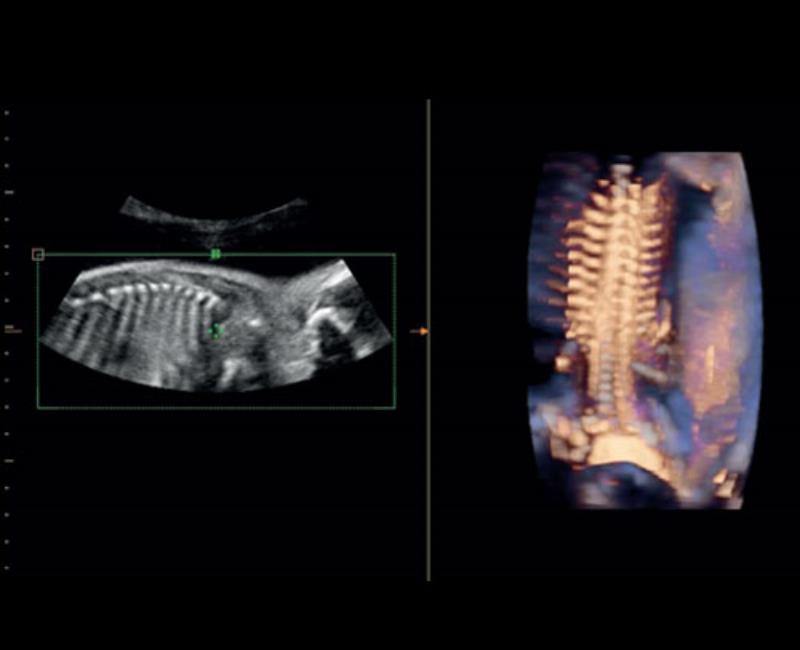 he thong sieu am mylab sigma