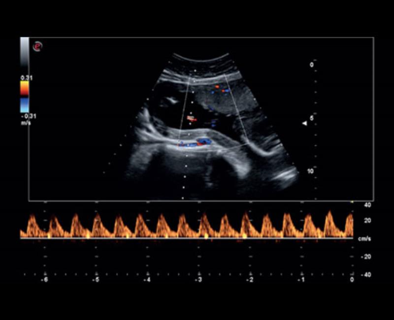 he thong sieu am mylab sigma
