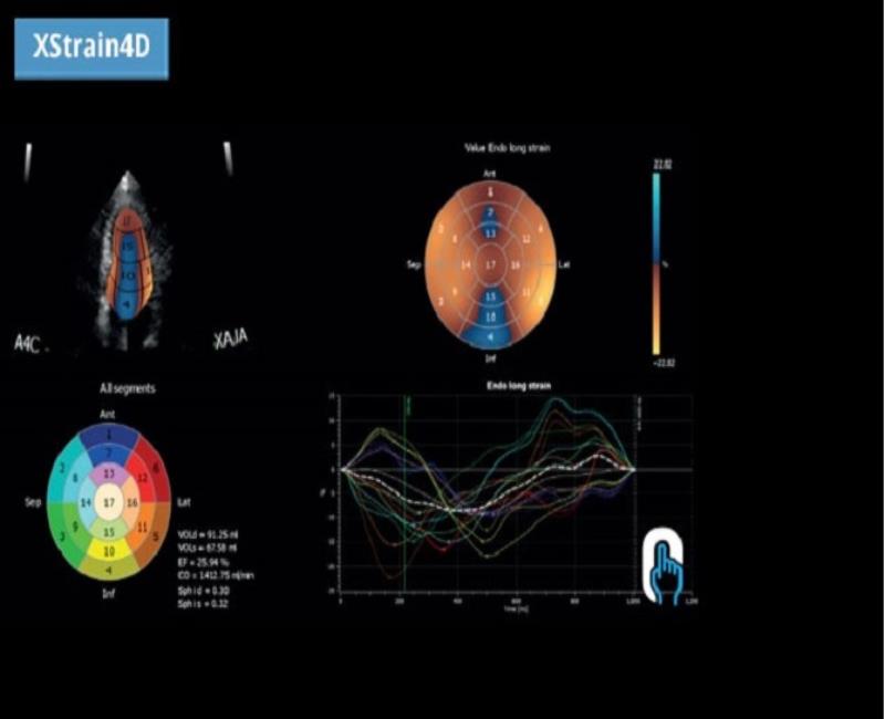 may sieu am mylab omega