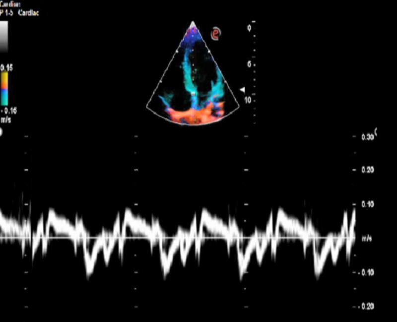 may sieu am mylab omega