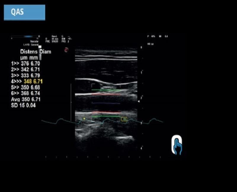 may sieu am mylab omega