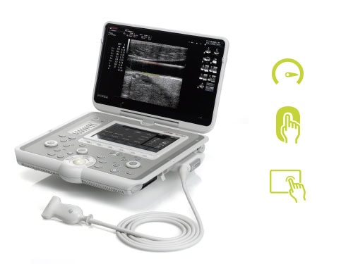 he thong sieu am mylab sigma