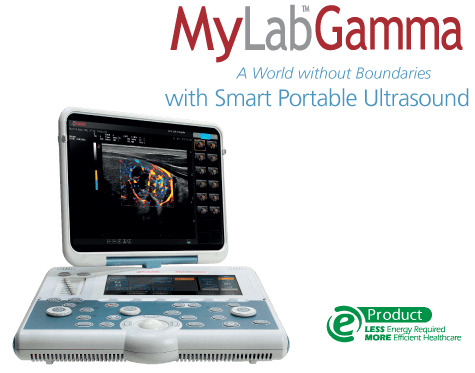 he thong sieu am mylab gamma