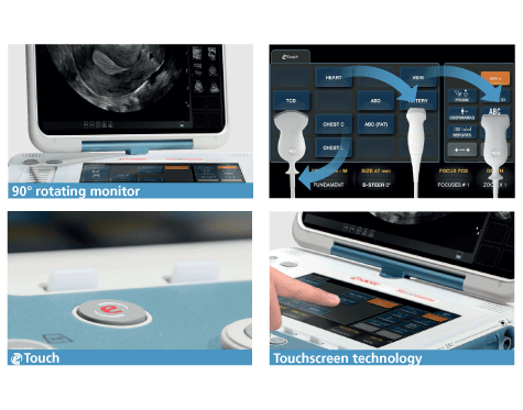 he thong sieu am mylab gamma