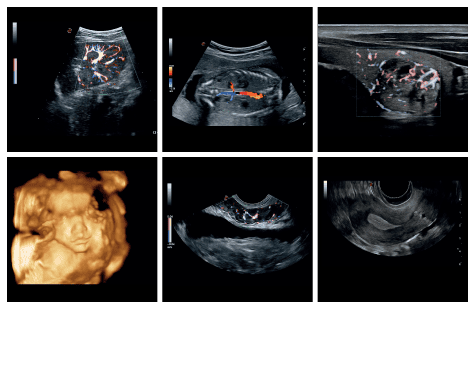 he thong sieu am mylab gamma