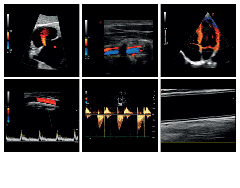 he thong sieu am mylab gamma