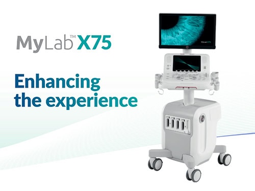 máy siêu âm mylab x75